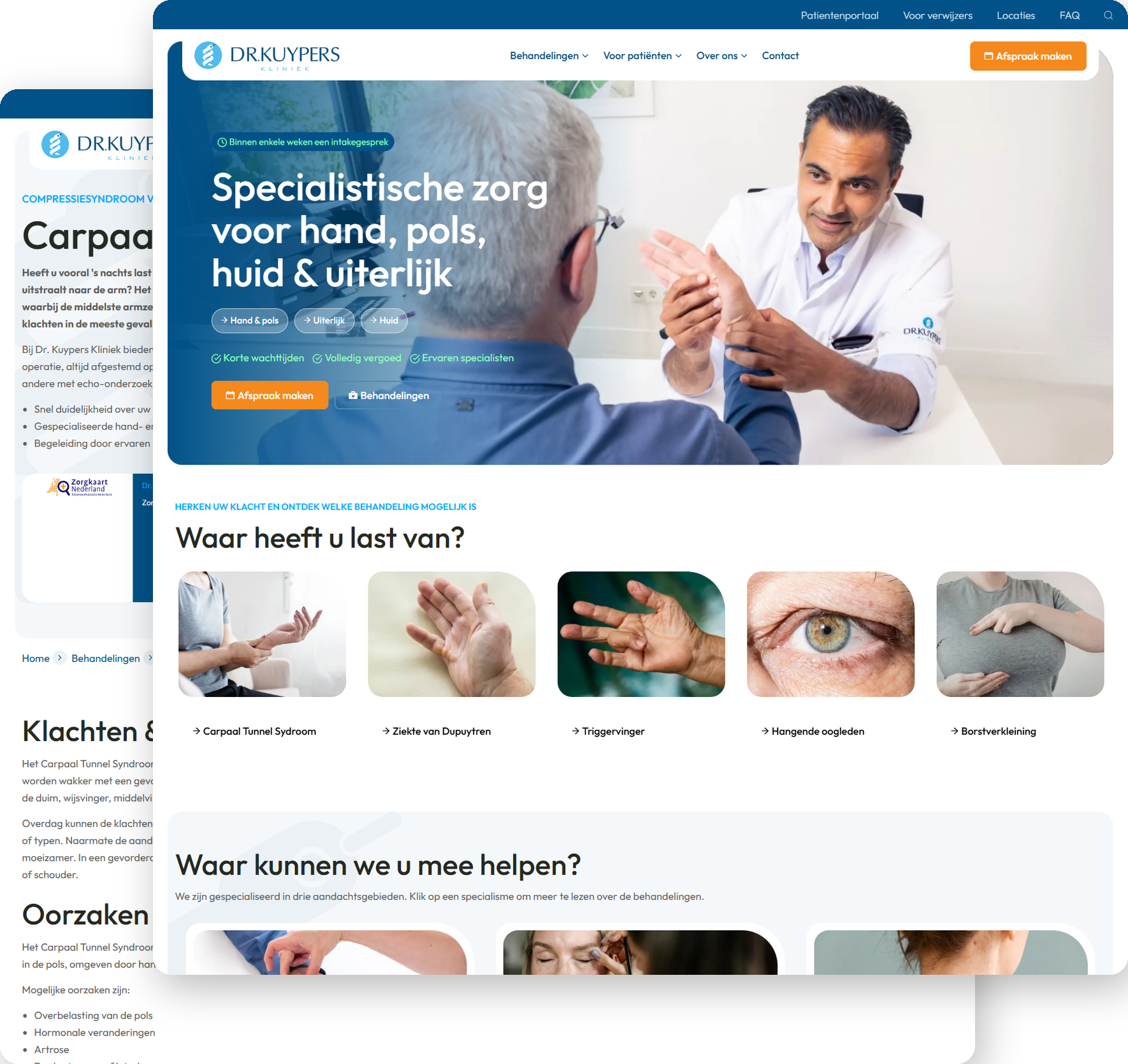 Homepage en behandelpagina Carpaal Tunnel Syndroom van de vernieuwde website van Dr. Kuypers Kliniek in Umbraco